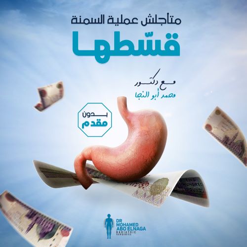 عملية تكميم المعدة بالتقسيط